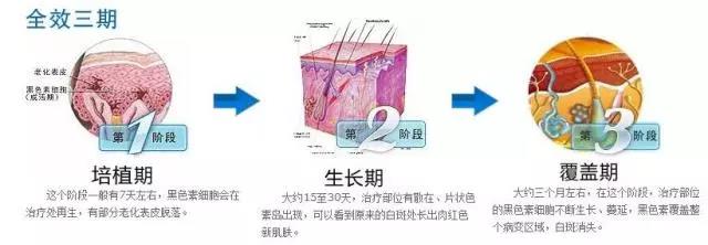 合肥华研白癜风医院在哪