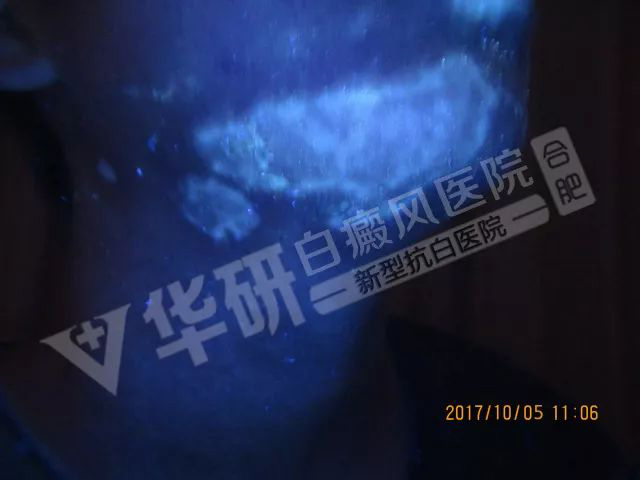 合肥华研医院收费水平