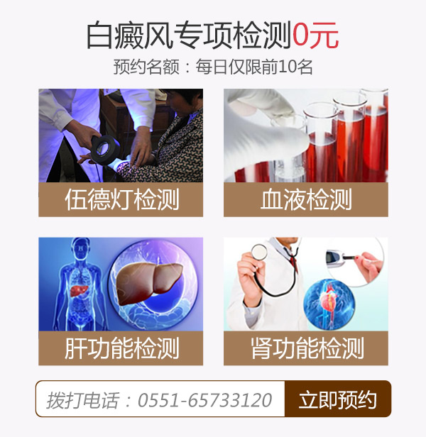 合肥治疗白癜风的医院