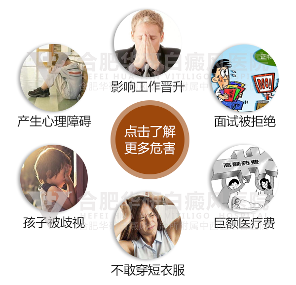 白癜风对成年人有哪些危害